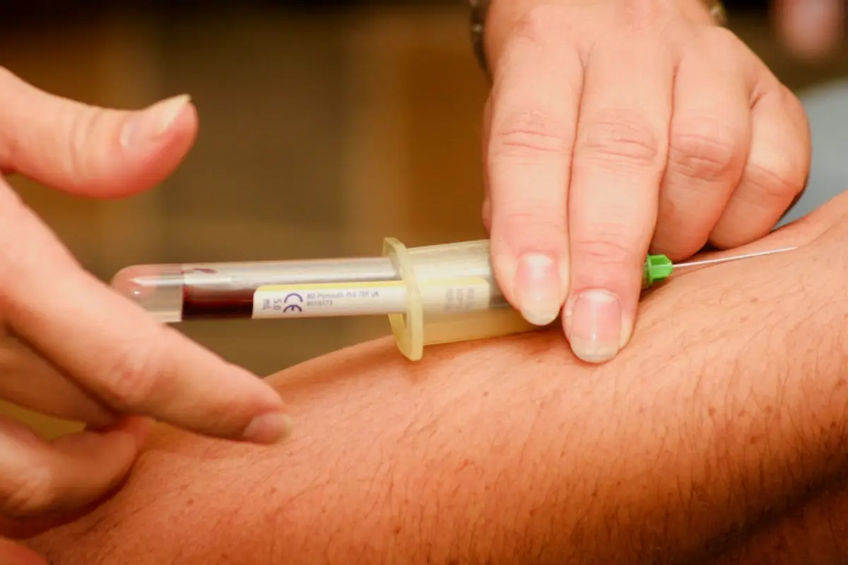 Non limitarti alle analisi di base: ecco gli esami fondamentali che ti salvano la vita e che spesso mancano